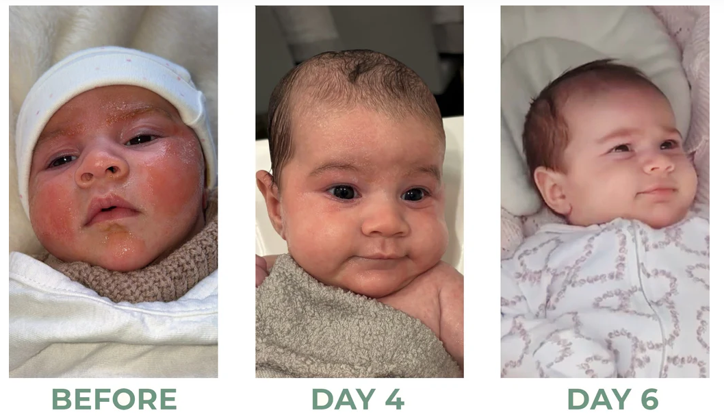 Kawakawa & Zinc Balm